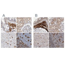 Invitrogen NAGK Polyclonal Antibody 100 &mu;L; Unconjugated:Antibodies,