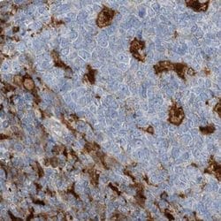 Invitrogen NAGK Polyclonal Antibody 100 &mu;L; Unconjugated:Antibodies,