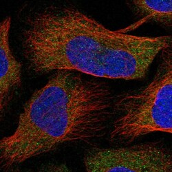 Invitrogen NAGK Polyclonal Antibody 100 &mu;L; Unconjugated:Antibodies,