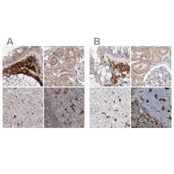 Invitrogen NAGK Polyclonal Antibody 100 &mu;L; Unconjugated:Antibodies,