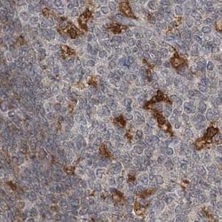 Invitrogen NAGK Polyclonal Antibody 100 &mu;L; Unconjugated:Antibodies,