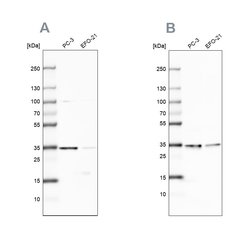 Invitrogen DNAJC9 Polyclonal Antibody 100 &mu;L; Unconjugated:Antibodies,