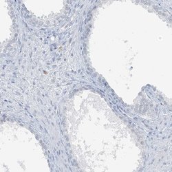 Invitrogen SCML1 Polyclonal Antibody 100 &mu;L | Buy Online | Invitrogen&trade; | Fisher Scientific