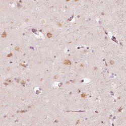 Invitrogen GRASP55 Polyclonal Antibody 100 &mu;L; Unconjugated:Antibodies,