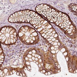 Invitrogen GRASP55 Polyclonal Antibody 100 &mu;L; Unconjugated:Antibodies,