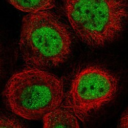 Invitrogen ACYP2 Polyclonal Antibody 100 &mu;L; Unconjugated:Antibodies,