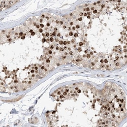 Invitrogen ACYP2 Polyclonal Antibody 100 &mu;L; Unconjugated:Antibodies,
