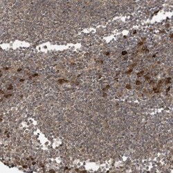 Invitrogen STX10 Polyclonal Antibody 100 &mu;L; Unconjugated:Antibodies,
