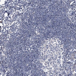 Invitrogen SCGB1D2 Polyclonal Antibody 100 &mu;L; Unconjugated:Antibodies,