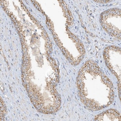 Invitrogen SCGB1D2 Polyclonal Antibody 100 &mu;L; Unconjugated:Antibodies,