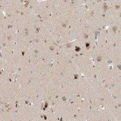 Invitrogen MXI1 Polyclonal Antibody 100 &mu;L; Unconjugated:Antibodies,