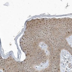 Invitrogen MXI1 Polyclonal Antibody 100 &mu;L; Unconjugated:Antibodies,