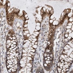 Invitrogen MXI1 Polyclonal Antibody 100 &mu;L; Unconjugated:Antibodies,