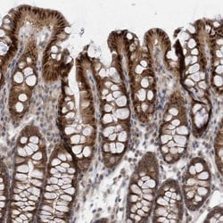 Invitrogen MXI1 Polyclonal Antibody 100 &mu;L; Unconjugated:Antibodies,