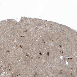 Invitrogen CACNB2 Polyclonal Antibody 100 &mu;L; Unconjugated:Antibodies,