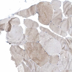 Invitrogen CACNB2 Polyclonal Antibody 100 &mu;L; Unconjugated:Antibodies,