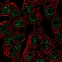 Invitrogen SLC5A11 Polyclonal Antibody 100 &mu;L; Unconjugated:Antibodies,