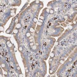 Invitrogen SLC5A11 Polyclonal Antibody 100 &mu;L; Unconjugated:Antibodies,