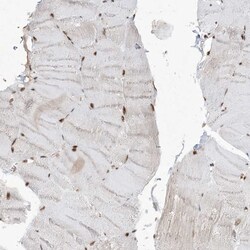 Invitrogen PPIL2 Polyclonal Antibody 100 &mu;L; Unconjugated:Antibodies,