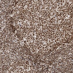 Invitrogen PPIL2 Polyclonal Antibody 100 &mu;L; Unconjugated:Antibodies,