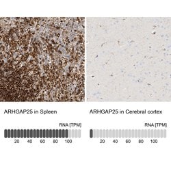 Invitrogen ARHGAP25 Polyclonal Antibody 100 &mu;L; Unconjugated:Antibodies,