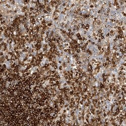 Invitrogen ARHGAP25 Polyclonal Antibody 100 &mu;L; Unconjugated:Antibodies,