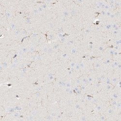 Invitrogen ARHGAP25 Polyclonal Antibody 100 &mu;L; Unconjugated:Antibodies,