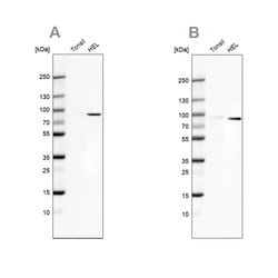 Invitrogen ARHGAP25 Polyclonal Antibody 100 &mu;L; Unconjugated:Antibodies,