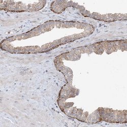 Invitrogen proCNP Polyclonal Antibody 100 &mu;L | Buy Online | Invitrogen&trade; | Fisher Scientific