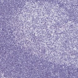 Invitrogen CCDC39 Polyclonal Antibody 100 &mu;L | Buy Online | Invitrogen&trade; | Fisher Scientific
