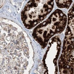 Invitrogen NDUFAF3 Polyclonal Antibody 100 &mu;L; Unconjugated:Antibodies,