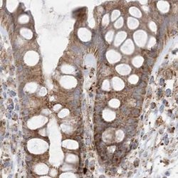 Invitrogen NDUFAF3 Polyclonal Antibody 100 &mu;L; Unconjugated:Antibodies,