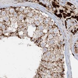 Invitrogen NDUFAF3 Polyclonal Antibody 100 &mu;L; Unconjugated:Antibodies,