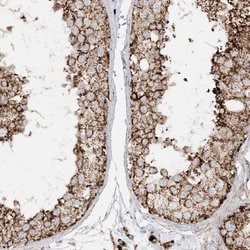 Invitrogen NDUFAF3 Polyclonal Antibody 100 &mu;L; Unconjugated:Antibodies,