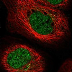 Invitrogen ERI2 Polyclonal Antibody 100 &mu;L; Unconjugated:Antibodies,