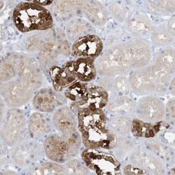 Invitrogen ERI2 Polyclonal Antibody 100 &mu;L; Unconjugated:Antibodies,