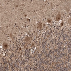 Invitrogen UBR3 Polyclonal Antibody 100 &mu;L; Unconjugated:Antibodies,