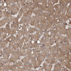 Invitrogen UBR3 Polyclonal Antibody 100 &mu;L; Unconjugated:Antibodies,