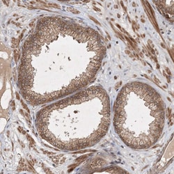 Invitrogen UBR3 Polyclonal Antibody 100 &mu;L; Unconjugated:Antibodies,