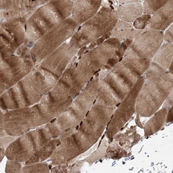 Invitrogen UBR3 Polyclonal Antibody 100 &mu;L; Unconjugated:Antibodies,