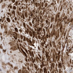 Invitrogen DHX36 Polyclonal Antibody 100 &mu;L; Unconjugated:Antibodies,