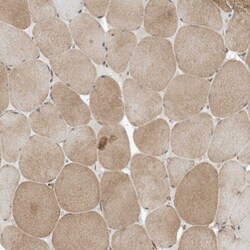 Invitrogen DHX36 Polyclonal Antibody 100 &mu;L; Unconjugated:Antibodies,
