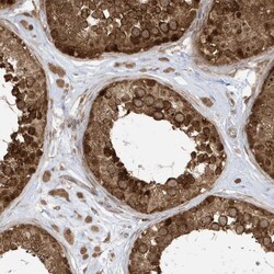 Invitrogen DHX36 Polyclonal Antibody 100 &mu;L; Unconjugated:Antibodies,