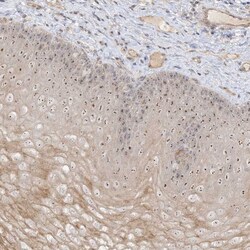 Invitrogen DDX18 Polyclonal Antibody 100 &mu;L; Unconjugated:Antibodies,