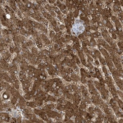 Invitrogen ADI1 Polyclonal Antibody 100 &mu;L; Unconjugated:Antibodies,