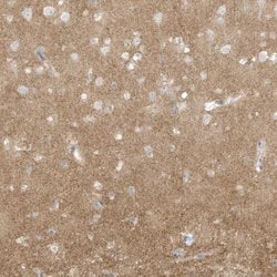 Invitrogen Arhgef9 Polyclonal Antibody 100 &mu;L; Unconjugated:Antibodies,