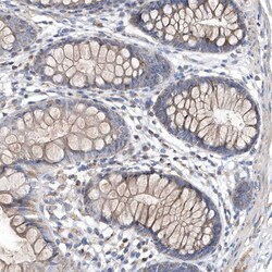 Invitrogen METTL8 Polyclonal Antibody 100 μL; Unconjugated:Antibodies,