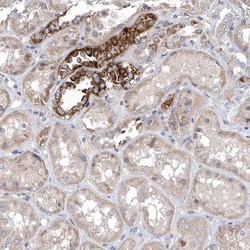 Invitrogen METTL8 Polyclonal Antibody 100 μL; Unconjugated:Antibodies,