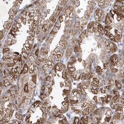 Invitrogen METTL8 Polyclonal Antibody 100 μL; Unconjugated:Antibodies,