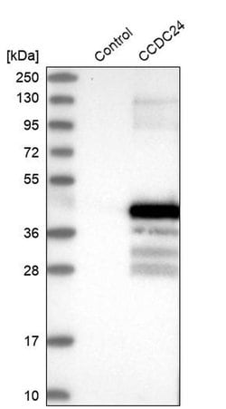 Invitrogen CCDC24 Polyclonal Antibody 100 &mu;L; Unconjugated:Antibodies,